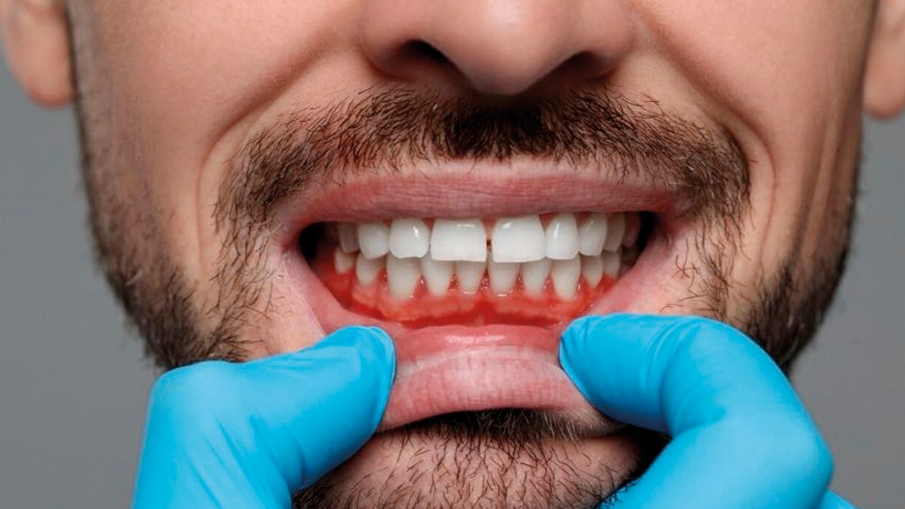 El cuidado de las encías