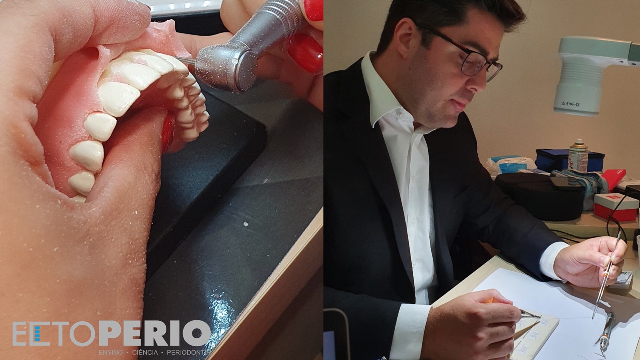 Iconic: Perfeccionamiento en Periodoncia Estética