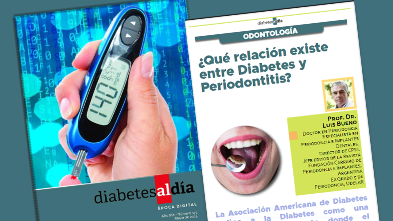 ¿QUÉ RELACIÓN EXISTE ENTRE DIABETES Y PERIODONTITIS?